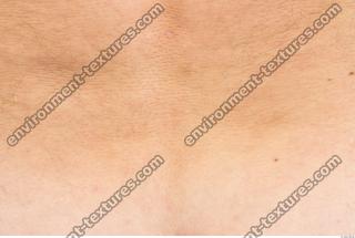 photo texture of white skin 0030